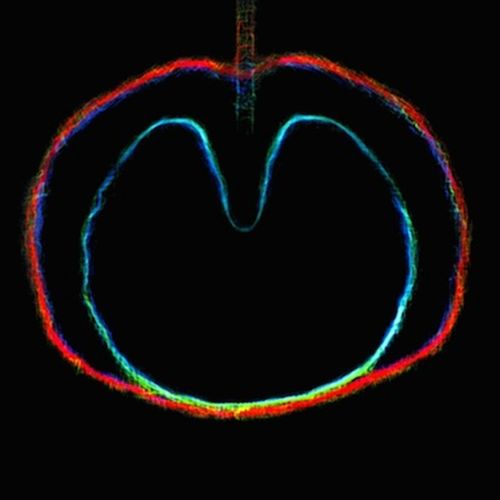 Wasp Star (Apple Venus, Pt. 2) cover art