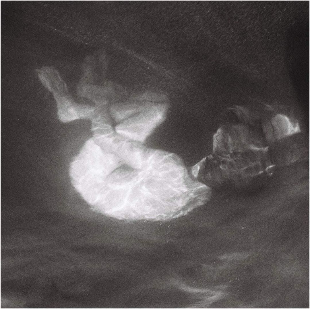 Glow cover art