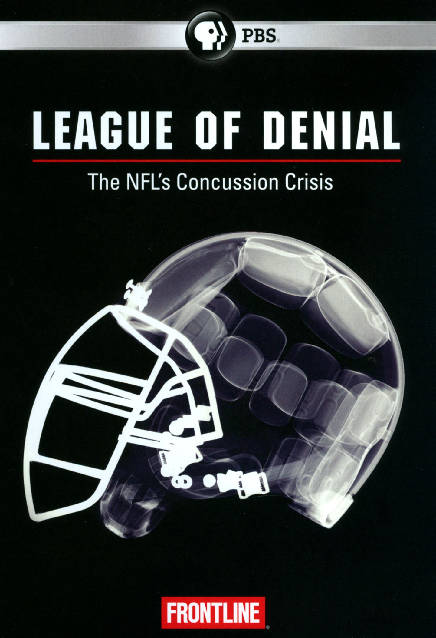 Frontline: League of Denial - The NFL's Concussion Crisis cover art