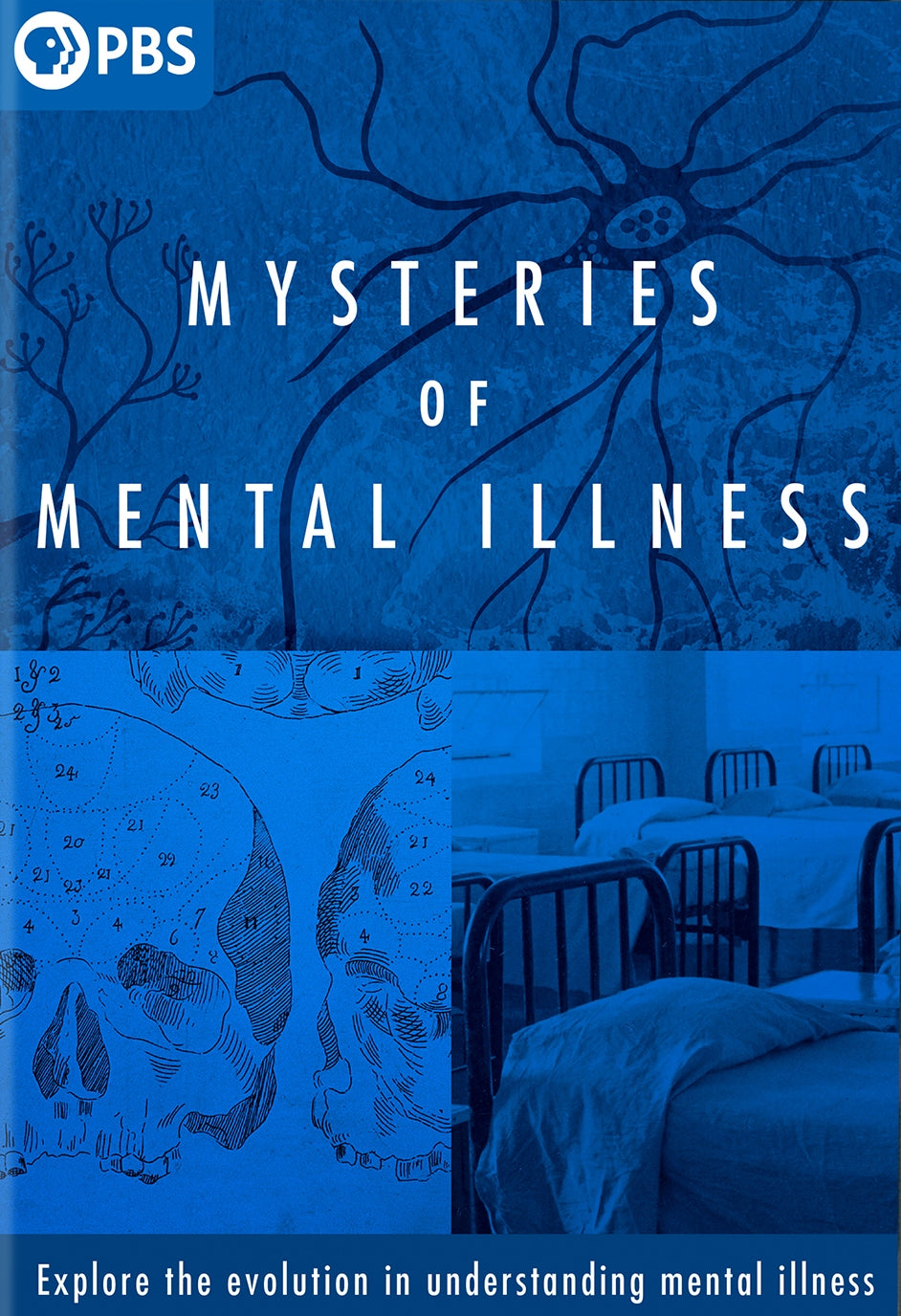 Mysteries of Mental Illness cover art