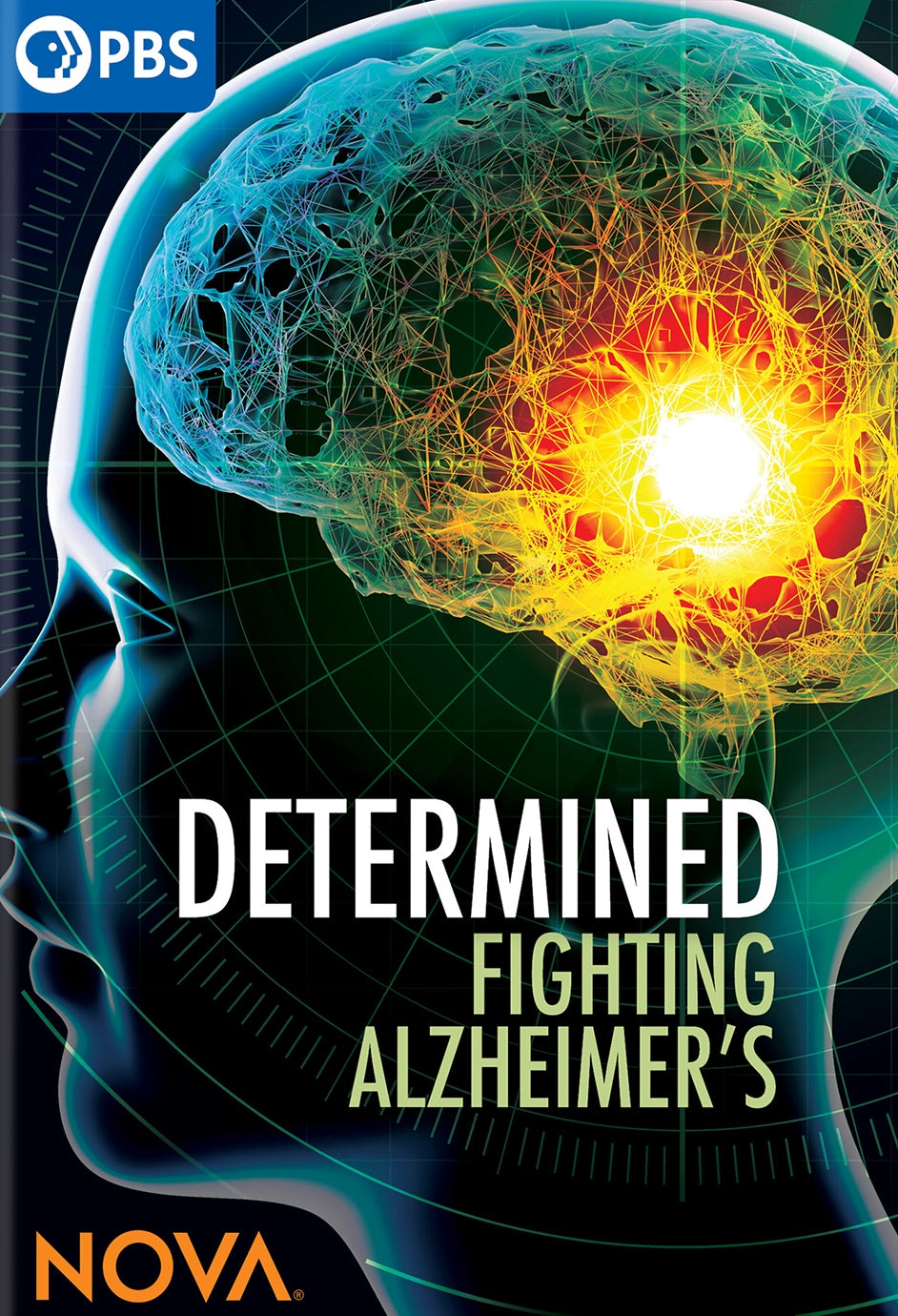 NOVA: Determined - Fighting Alzheimer's cover art