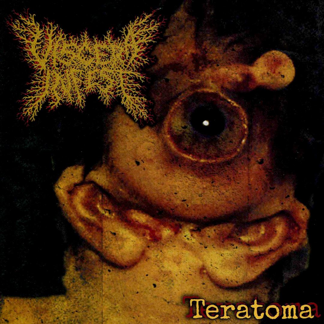 Teratoma cover art