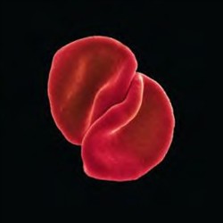 Scratch My Back cover art