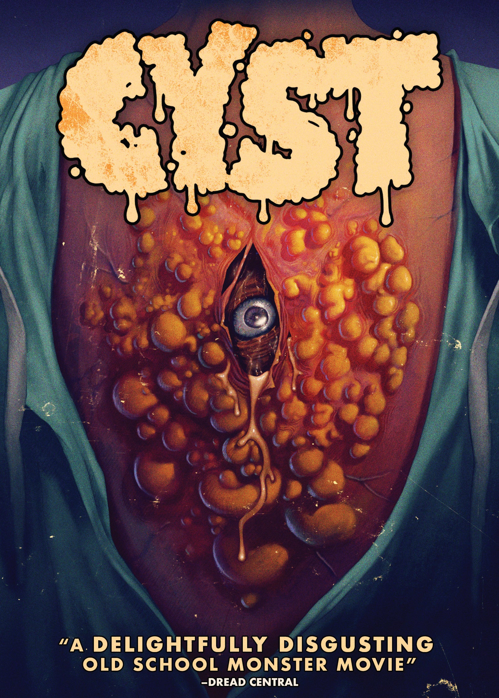 Cyst cover art