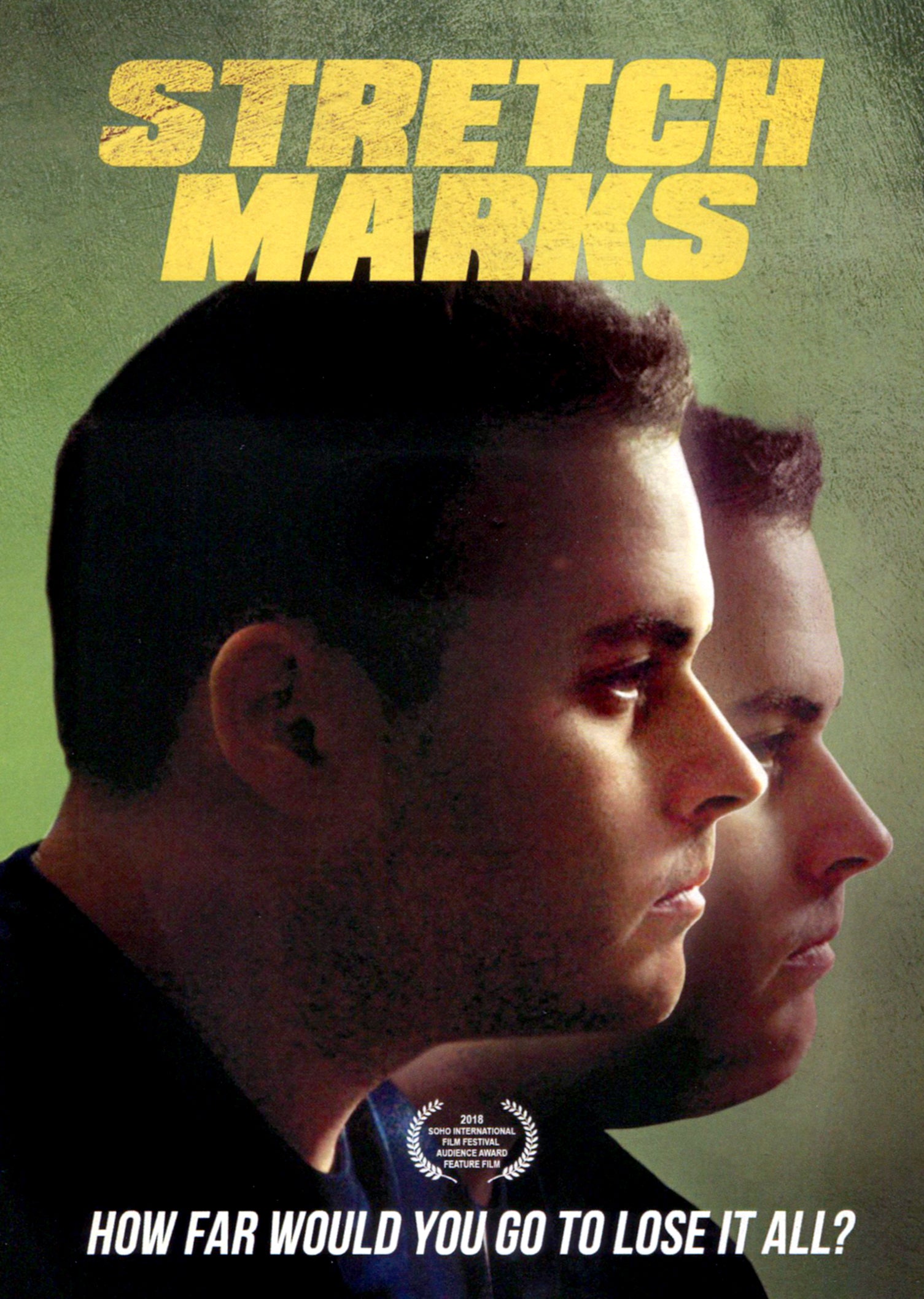 Stretch Marks cover art