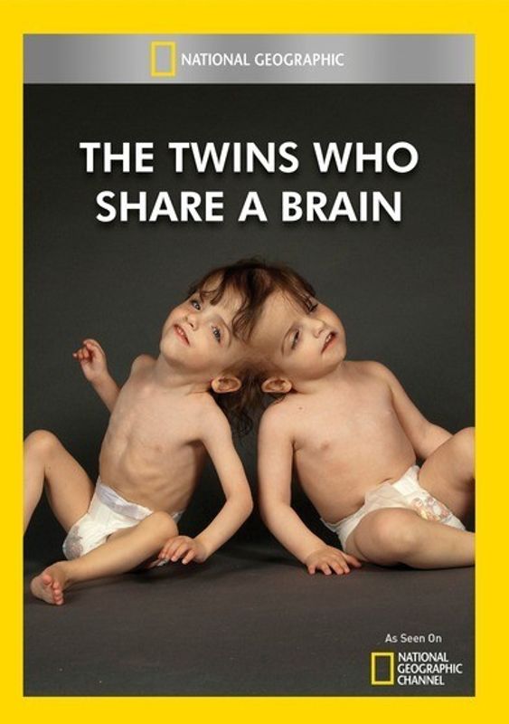 Twins Who Share a Brain cover art
