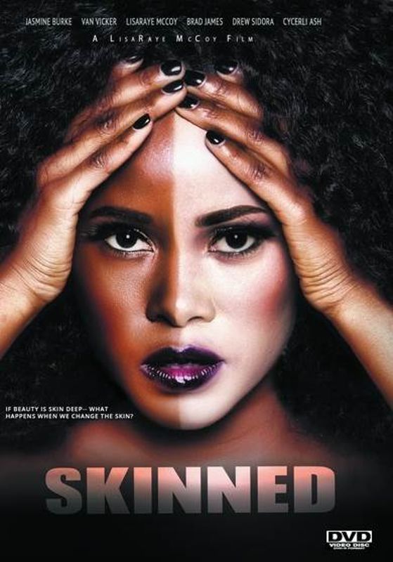 Skinned cover art