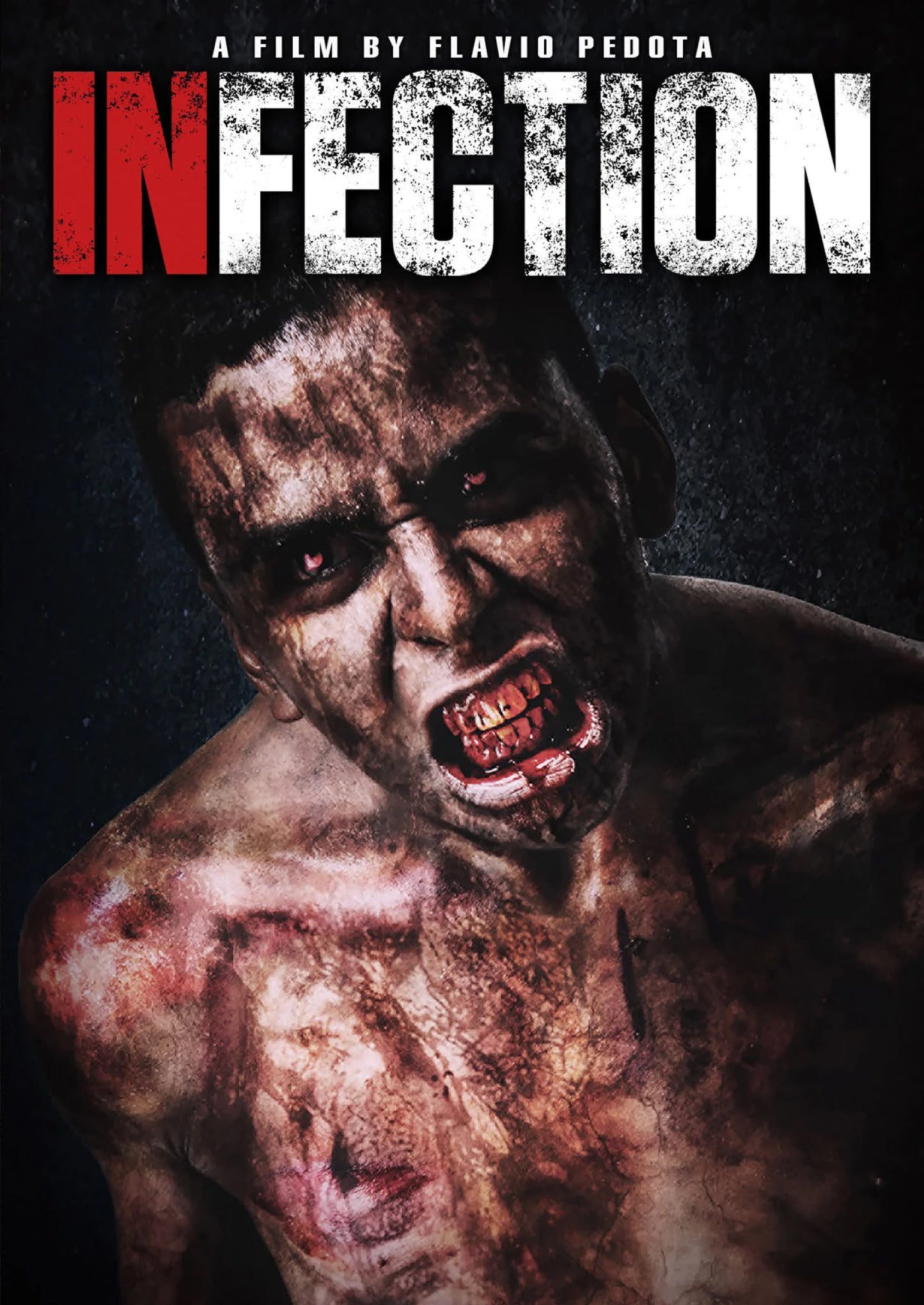 Infection cover art