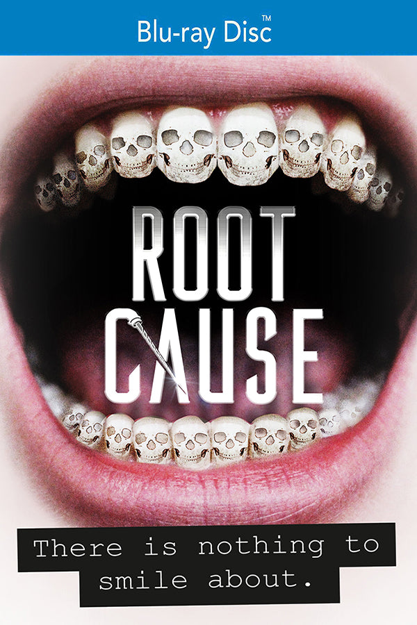 Root Cause [Blu-ray] cover art