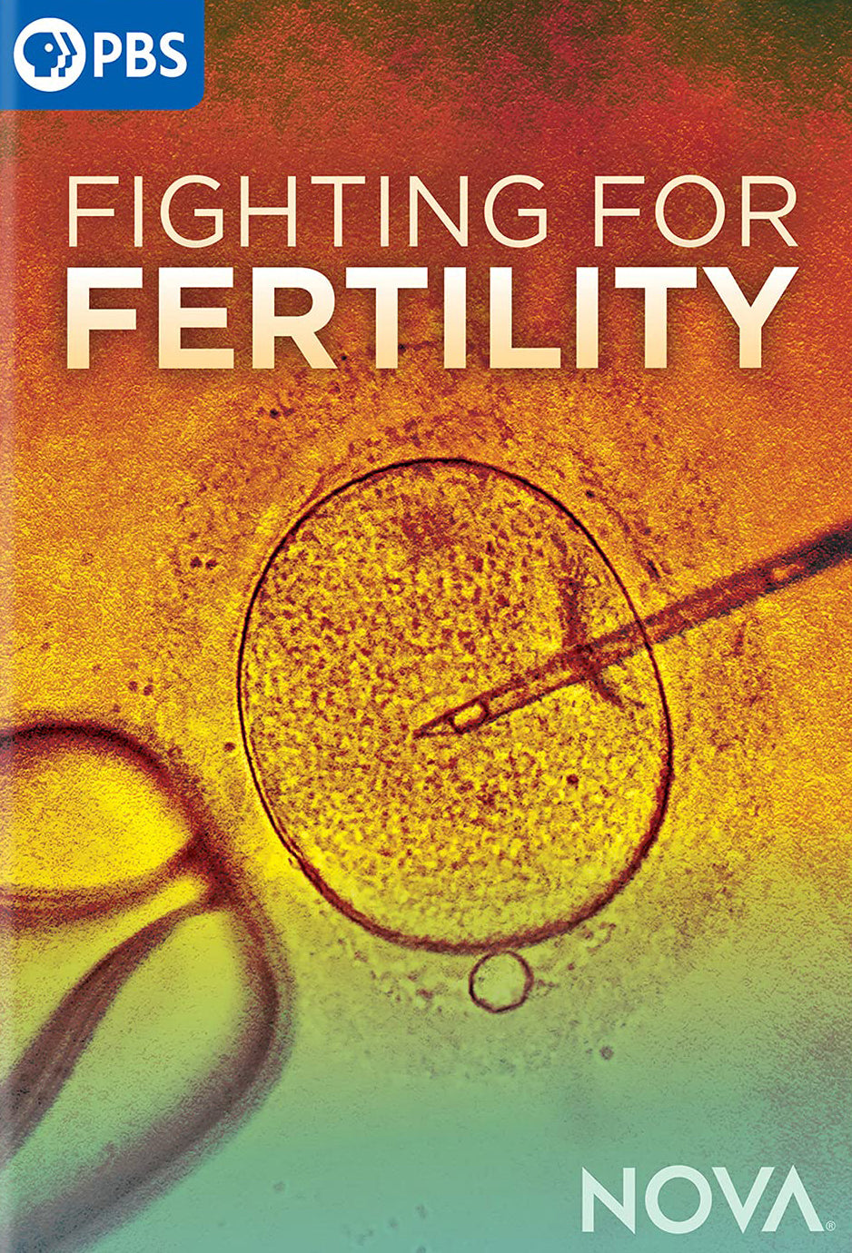 NOVA: Fighting for Fertility cover art