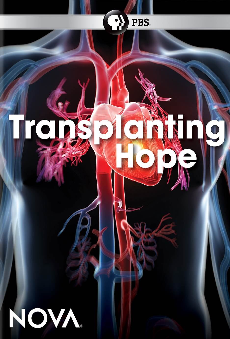 NOVA: Transplanting Hope cover art